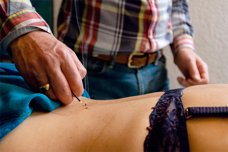 Traitement par moxibustion, acupuncture japonaise, cabinet Laserson